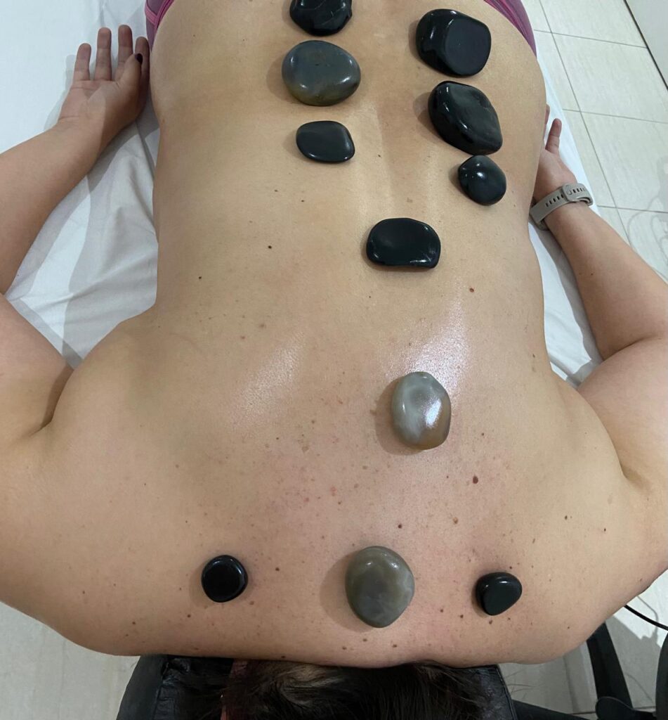 Massagem com pedras quentes realizada pela RN Clínica